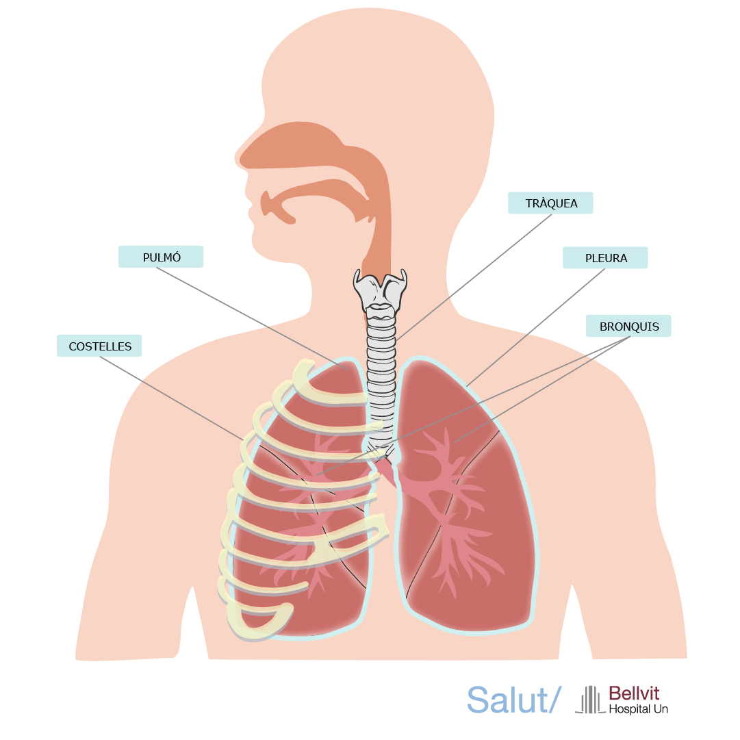 Resecció pulmonar HUB