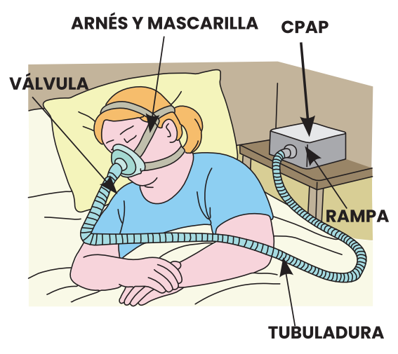 cpap