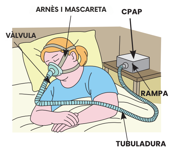 cpap