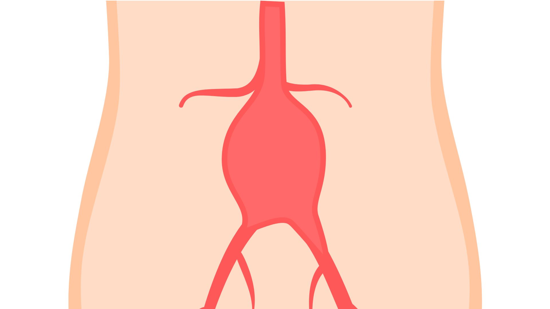 aaa