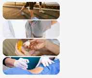 Espondiloartrosi Espondiloartrosi