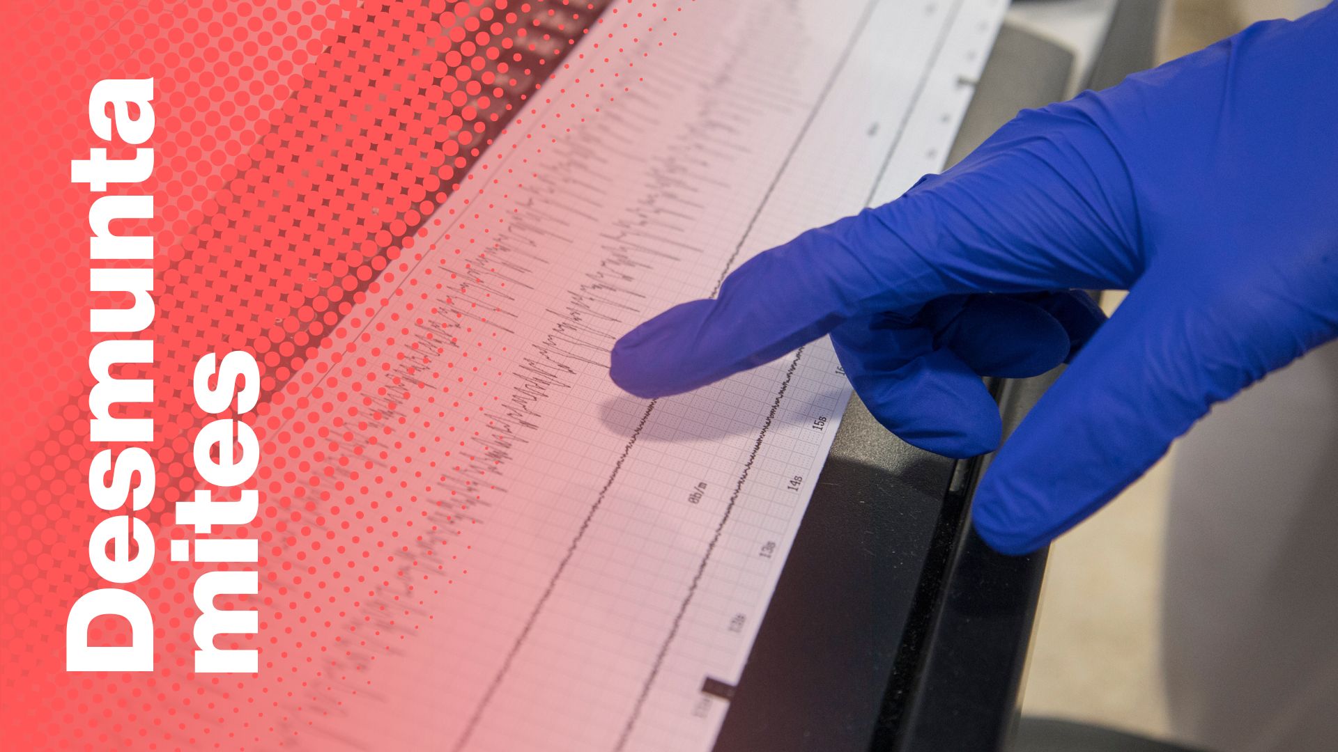 desmuntamites teràpia electroconvulsiva