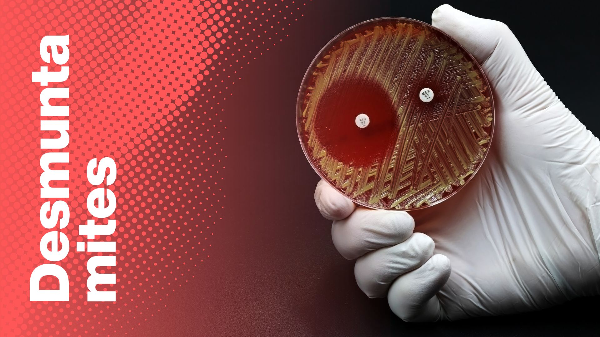 desmuntamites Septicèmia