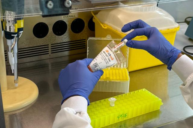 Es desenvolupa a Catalunya el primer biomarcador en sang capaç d’anticipar la progressió a demència d’Alzheimer