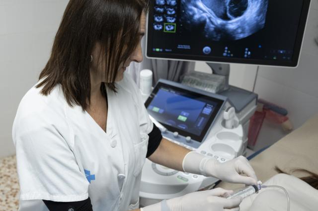 Bellvitge valida una alternativa menys invasiva a la cirurgia per tractar l’endometriosi  