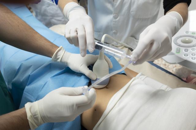 Bellvitge valida una alternativa menys invasiva a la cirurgia per tractar l’endometriosi  