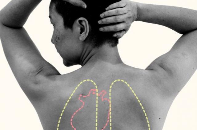 II Jornada per a pacients trasplantats d'òrgan sòlid