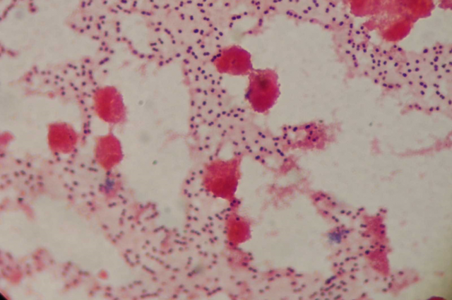 Cinquanta anys de dades de Bellvitge permeten reconstruir amb la genòmica com han canviat el pneumococ, les resistències i la meningitis 