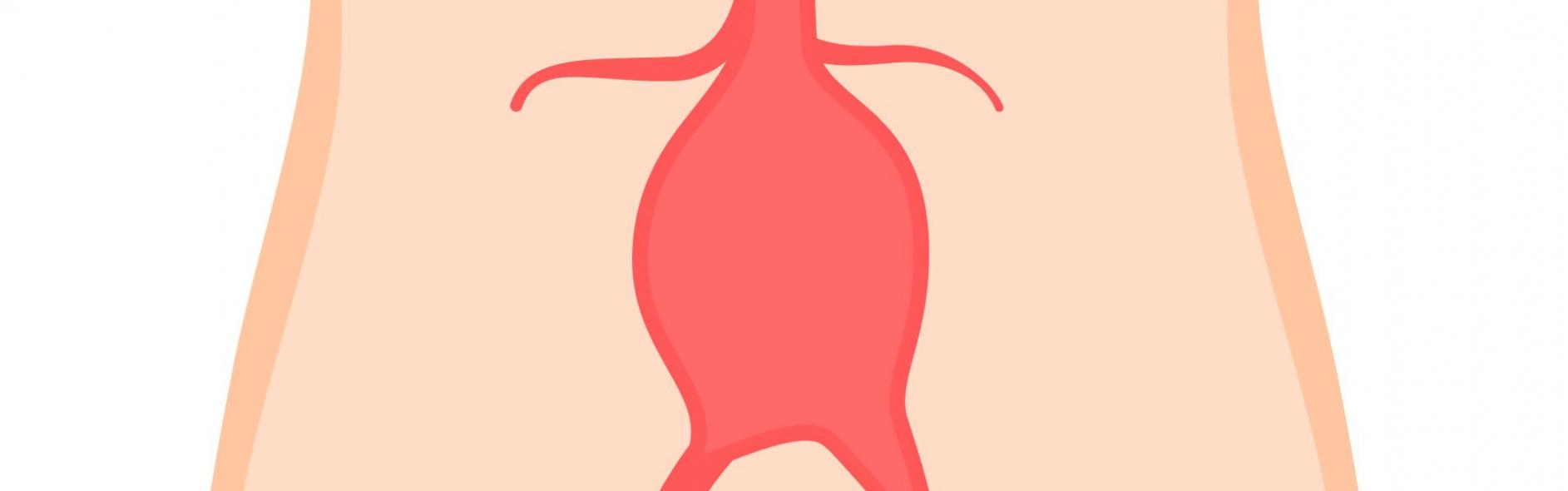 aaa