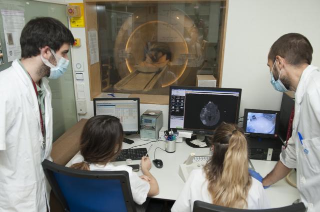 Un biomarcador d’imatge pot ajudar a comprendre i tractar millor l’esclerosi múltiple progressiva