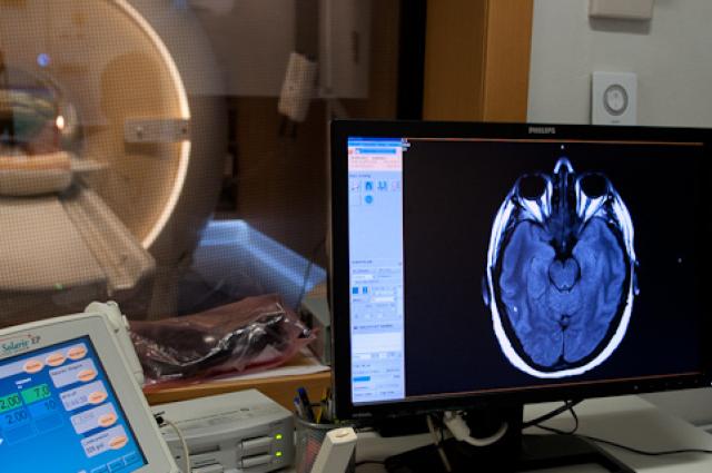 L'HUB i l'IDIBELL participen en una publicació científica que aporta nous coneixements a la malaltia de Huntington