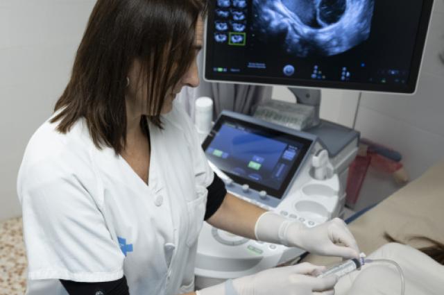 Bellvitge valida una alternativa menys invasiva a la cirurgia per tractar l’endometriosi  