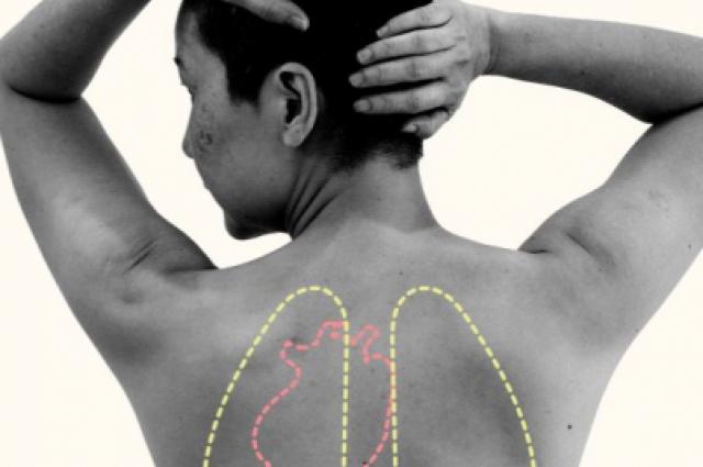 II Jornada per a pacients trasplantats d'òrgan sòlid