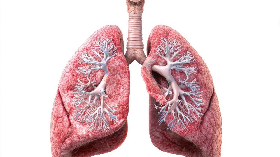 salut pulmonar