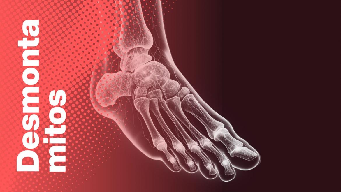 Desmuntamites neuroma de Morton castellà