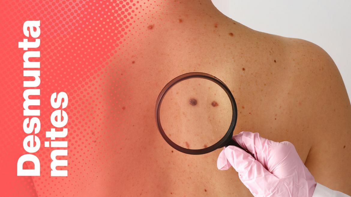 desmuntamites melanoma 