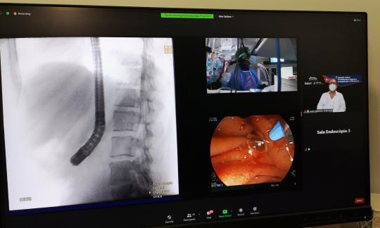 La Unitat d'Audiovisuals ha col·laborat en més de 25 vídeos de tècniques d'endoscòpia avançada